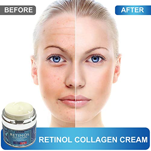 Retinol Cream For Face - Facial Moisturizer With Collagen Cream And Hyaluronic Acid, Anti-Wrinkle Reduce Fine Lines With Vitamin C+E Natural-Ingredient Day And Night Anti-Aging Cream For Women And Men #TOP6