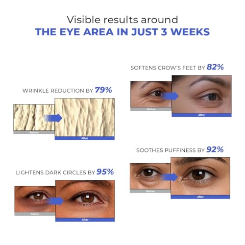 Image of Conscious Chemist Retinol Peptide Under Eye Cream With Soothing Massage Roller | Under Eye Roll On For Dark Circles, Fine Lines & Puffy Eyes | For Women & Men | 15 ml (Pack of 2)