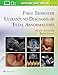 First Trimester Ultrasound Diagnosis of Fetal Abnormalities