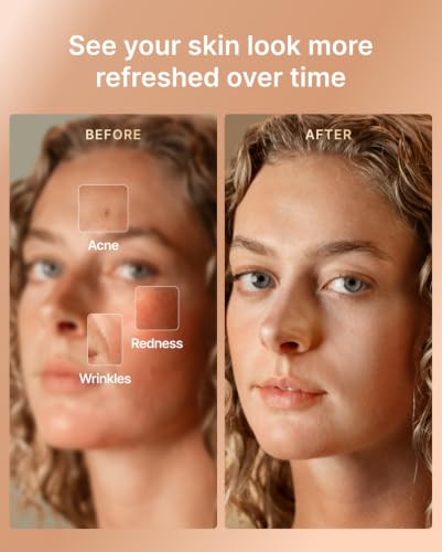 Image of RENPHO Red Light Therapy Mask for Face, FDA-Cleared,Birthday Gifts for Wife