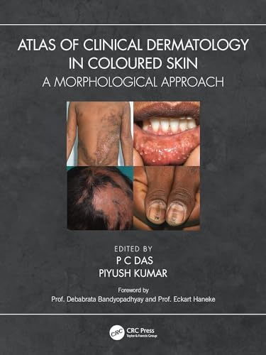 Image of ATLAS OF CLINICAL DERMATOLOGY IN COLOURED SKIN A MORPHOLOGICAL APPROACH (PB 2024)