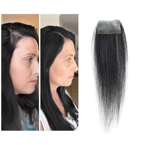 Meiverah scar human hair replacement Accidental burns without hair for men women Hairline Loss Straight Tape in Replacement Toupee (Jet Black, 0.78