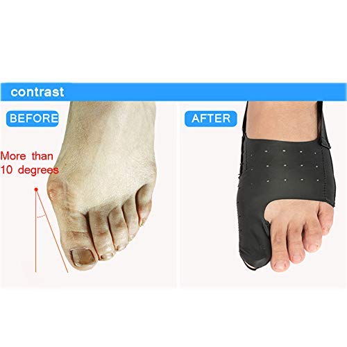 Bunion Corrector Bunion Splint Zehenglätter Bunion Corrector 2 Stück Bunion Splints Zehenspreizer für Hammerzehen | Krallenzehenkorrektur, Hallux-Valgus-Schienen zur Linderung von Ballenzehen (L)