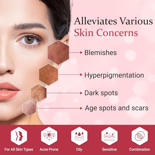 Image of IHC- Glow Skin Brightening Cream | Anti-melasma cream, Pigmentation removal cream, Helps to remove Acne Scar, Dark /Age Spots, Uneven Skin Shade I Enriched with kojic Acid 2%, Vitamin E, 1.5% Alpha Arbutin, Niacinamide, Hyaluronic Acid | For All Skin Types (20g )
