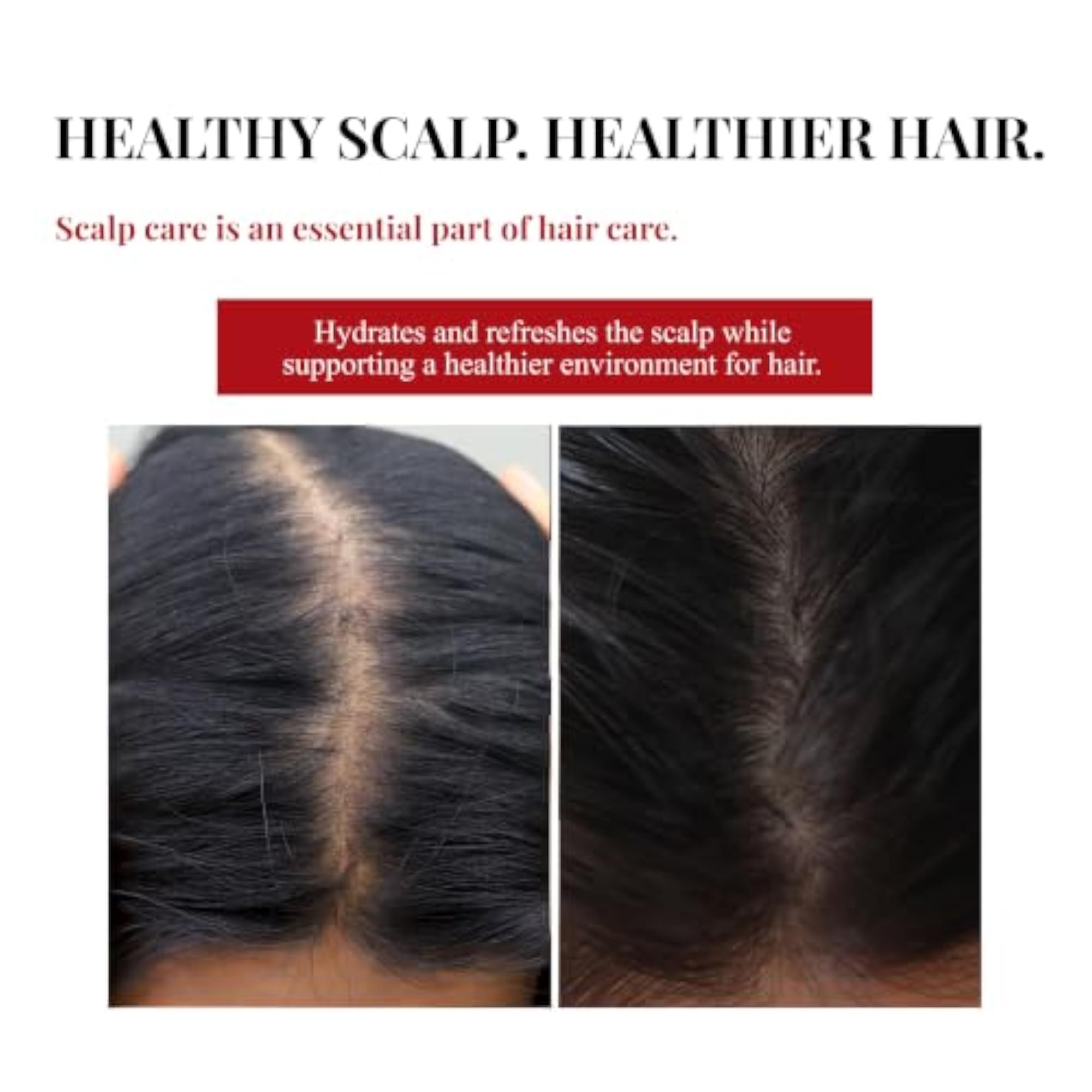 Hair Growth Serum with Redensyl & Procapil, 40ml