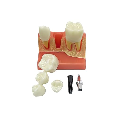 Miniatura 23 de 2 modelos de dientes estándar, modelo dental para adultos, modelo estándar de demostración de Typodont para niños, enseñanza dental, pantalla