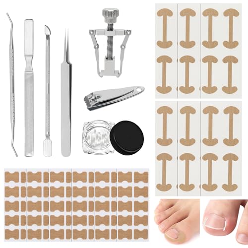 Eingewachsene Zehennägel Set 120 Stück Zehennagel Korrektur Set mit Nagelkorrektur Patch Edelstahl Nagelknipser Nagelschieber Nagelfeile Pinzette Fusspflege Werkzeugset zur Schmerzlinderung