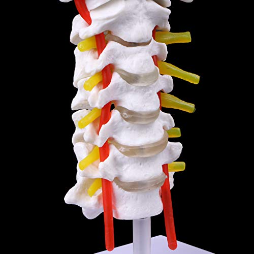 Expliquer la hernie cervicale avec le modèle colonne et nerfs rachidiens - 5