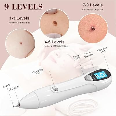 LM 1000 SkinTag Remover Home Use, Removal of Common Warts, SkinTags | Easy to Use