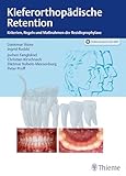 Kieferorthopädische Retention: Kriterien, Regeln und Maßnahmen der Rezidivprophylaxe