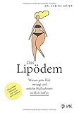  Das Lipödem: Warum jede Diät versagt und welche Maßnahmen wirklich helfen