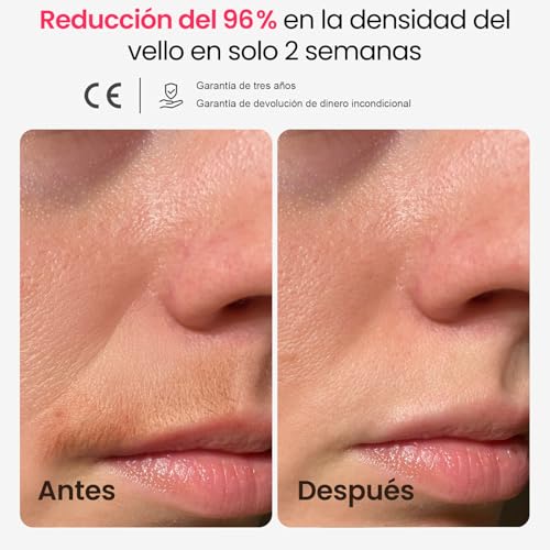 25J Depiladora Laser, Depiladora Luz Pulsada Mujer Hombre con TRIPLE-Pulso, 12 cm² Indolora Zafiro 3℃ Hielo Enfriamiento, Depilación Permanente para Cara, Axilas, Bikini（Azul marino） - imagen 3