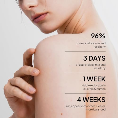 Image of BellamiLuxx Fungal Acne Treatment Lotion: Effective Face & Body Pimple Cream for Bumps, Clusters, Itch & Redness - Fungal Prone Skin Acne Treatment Moisturizer for Teens & Adults with Natural Actives
