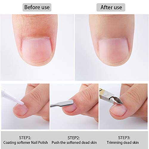 Huture Hautzangen Kurzer Eckenheber Nagelhautschieber Nagelhautzange Hautzange mit Doppelfeder Nipper Clipper Pusher… – Bild 6