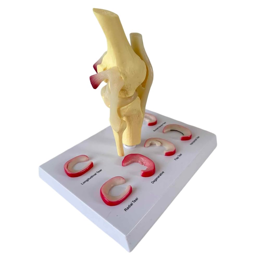 Modelo de articulación de Rodilla Humana Modelo de lesión de menisco Modelo de reparación de ligamento de Rodilla