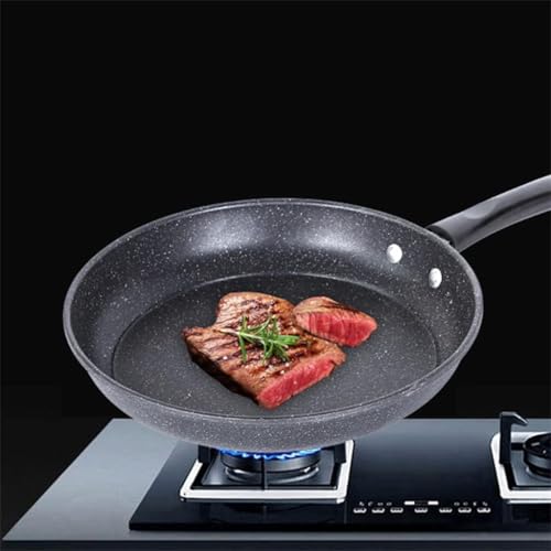 Casserole marmite ensemble cuisine RUVOO antiadhésif sans gras