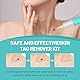 FLETUTE Stielwarzen Entferner Profi-Set - Sanftes Warzenentferner System für glatte Haut, Dermatologisch Empfohlenes Hautpflege-System für Frauen & Männer​