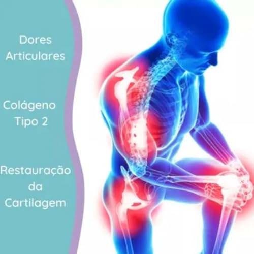 Suplemento Articulice, Colágeno Tipo 2, Ácido Hialurônico, Glicosaminoglicano c/ 30 comprimidos