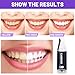 GASRONS Purple Toothpaste whitening, Purple Teeth Whitening, Tooth Stain Removal, Teeth Whitening Booster, Teeth Whitener