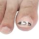 Nagelkorrekturspange Supvox aus Edelstahl für eingewachsene Zehennägel