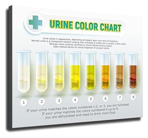 Hydration Level Chart Urine Color Poster Print Health Education Tool for Nursing Students Clinic Hospital Office Wellness Decor(