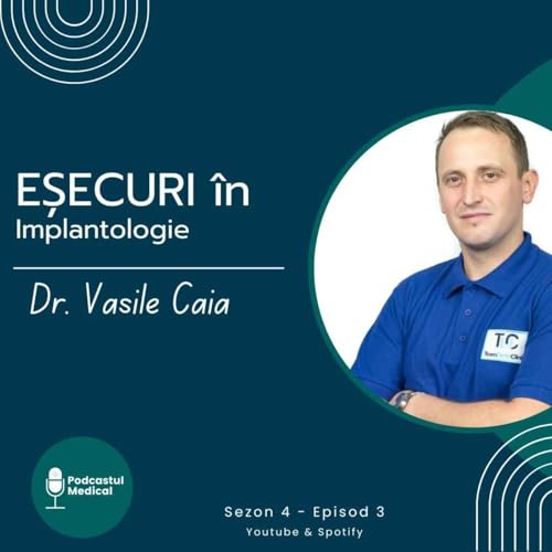 Dr. Vasile Caia | Eșecuri &icirc;n Implantologie