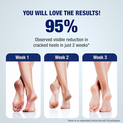 Image of Lunaris 20% Urea Foot Cream Roll On - 50ml | For Dry, Cracked Or Calloused Foot Skin Repair | With 2% Lactic Acid, Olive Oil & Vitamin E | Helps Moisturise & Exfoliates Dead Skin | Non Greasy