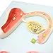 Fetal Model,Embryonic Development Process, Fertilization Zygote Formation and Uterine Implantation Female Uterus Ovary Model, Fetus Uterine Embryo Development Model,Fetal model