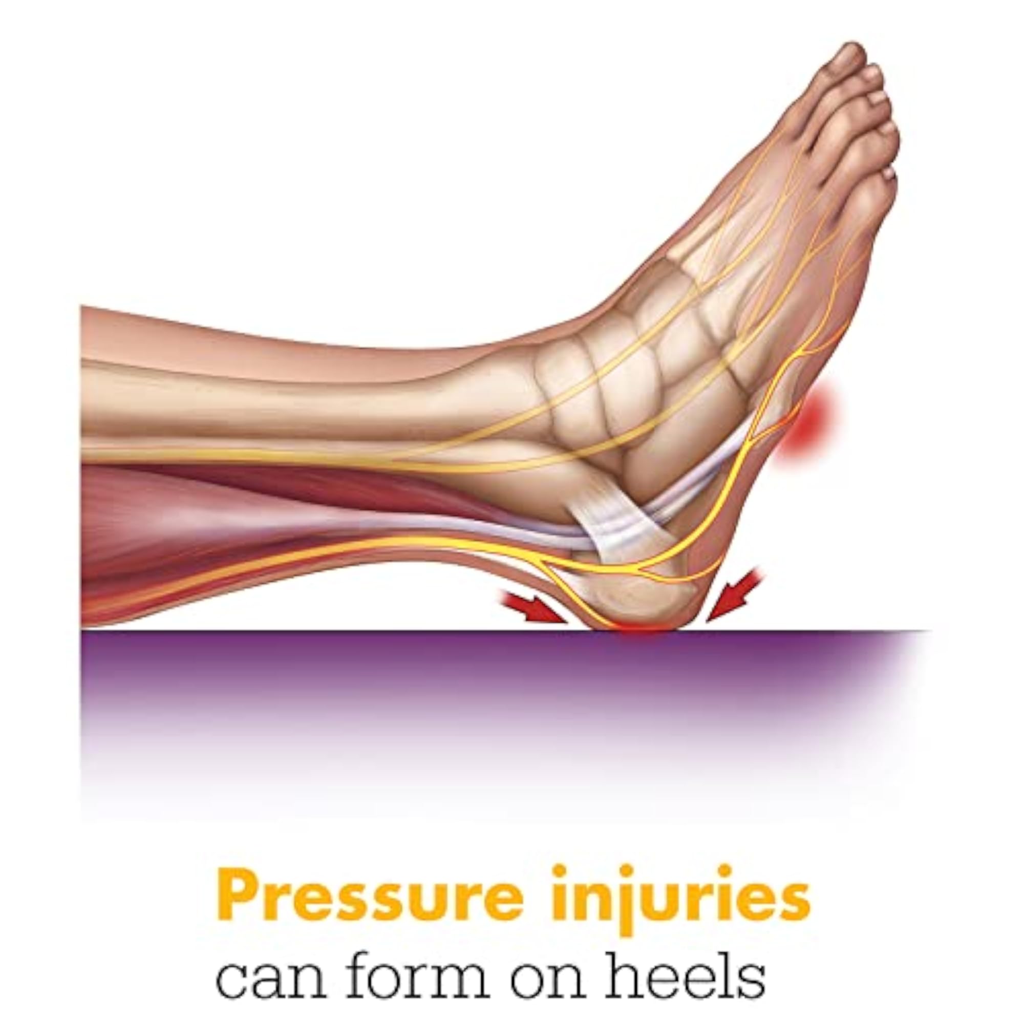 Prevalon Pressure-Relieving Heel Protector Case