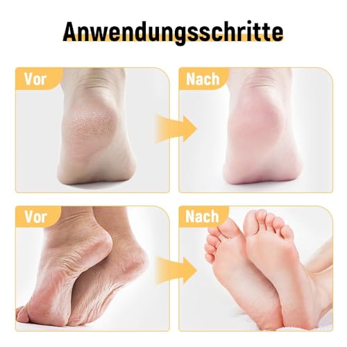 Hydrating and Anti-Cracking Foot Cream, 2025 Neuest Feuchtigkeitsspendende und Anti-Riss-Fußcreme, Urea Creme Fußpflegecreme Fußpflege Lindert Extreme Trockenheit und Rissbildung der Füße (1) – Bild 3