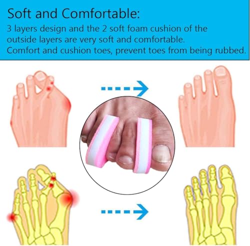 Image of 8 Pieces Premium Foam Toe Separators - Toe Spacers for Corn, Blister, and Hammer Toe Relief