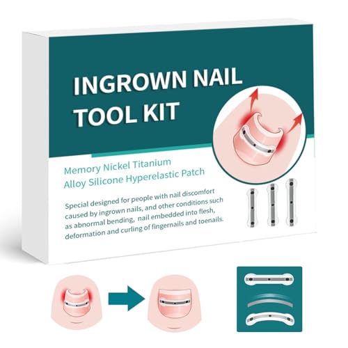 Titanium Alloy Silicone Ingrown Correction Tool Kit,Ingrown Toenail Treatment,Ingrown Toenail Removal Kit,Designed for Curved Nail Repair, nail Corrector,Cuttable Applicable to most sizes,reusable
