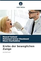 Krebs der beweglichen Zunge 6205232898 Book Cover