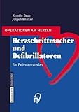 Herzschrittmacher und Defibrillatoren: Ein Patientenratgeber (Operationen am Herzen) (German Edition)