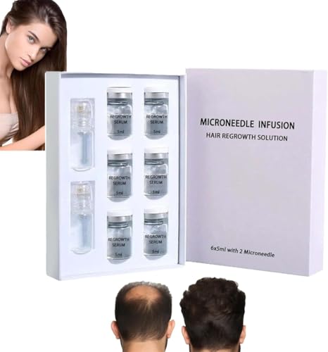 Hair Regrowth System - Microneedle Infusion Hair Regrowth Solution Painless Micro-Infusion Technology for Hair Growth Increases Serum Absorption by 300% (Set B)
