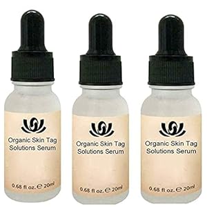 20 Ml Pijnloze Mole Skin Dark Spot Repair, Organic Tags Solutions Ser-um Original, For Removing Moles Moles Wratten Skin…