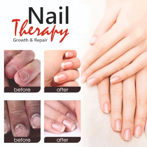 Image of SHILLS Professional 12 in 1 Nail Therapy | Nail Strengthener & Growth Treatment | Nail Hardener for Weak, Brittle & Peeling Nails | Repair, Hydrate, Nourish, Shine & Cuticle Care | Clear Nail Serum