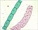 Prepared Slide, Spirogyra Classpack of 15 Sides
