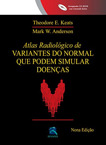 Atlas Radiológico de Variantes do Normal que podem Simular Doenças