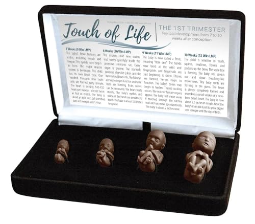 Fetal Model, Touch of Life, 1st Trimester, Black Sidewalk Version