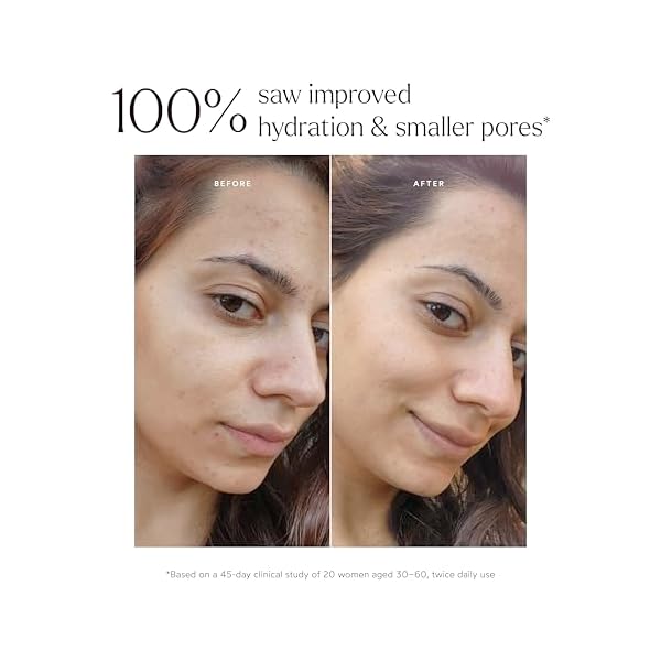 True Botanicals Renew Pure Radiance Oil | All Skin Types | Anti-Aging Face Oil w/Algae Extract | Treats Fine Lines & Wrinkles | Dermatologist Tested, All Natural, Vegan | 1 fl oz | 30 ml - Image 5