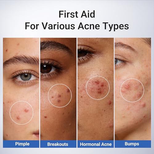 1.8% Salicylic Acid Spot Serum, Acne Treatment for Acne-Prone Sensitive Skin | Niacinamide, Fast Pimple Relief, Fades Acne Marks, Overnight & Period Breakouts, 0.34 fl oz (20 ml) - Image 6