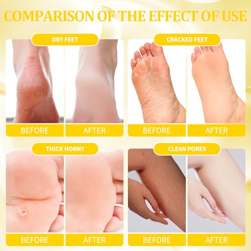 nbc BeautiLab Pedicure Kit Foot Soak Set: Bubble Salt, Sugar Scrub, Massage Mask, Massage Lotion in a Box, 4 Step Foot Spa Kit for Dry Feet, Calluses and Tired Feet(3 Set Milky Flower)