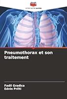 Pneumothorax et son traitement (French Edition) 6207826671 Book Cover