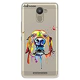 ❤ Diseño: 【 Transparente 】que deja ver el color original de su teléfono