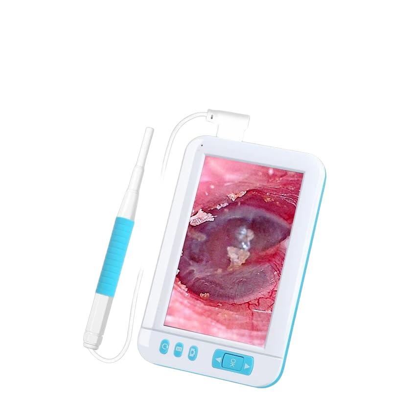 QiudanTimes HD Camera Endoscope HD1080P Ear Cleaner Screen Otoscope Digital Endoscope 4.3 inch HD Screen Camera Digital Ear Monitor Earpick(4.3'-3.9mm)