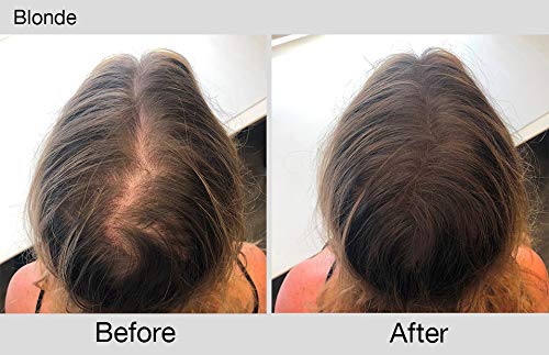 Joan Rivers Great Hair Day Root Touch Up Powder for Thinning Hair - Root Cover Up Hair Powder for Thicker, Fuller Looking Hair - Fill-In Powder and Gray Hair Coverage (Blonde) - Thumbnail 4