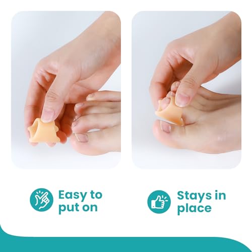 Correttore Per Dita Dei Piedi A Martello Per Donne - Raddrizzatori Per Dita Dei Piedi In Morbido Gel - Riallineamento Di Dita Dei Piedi Piegate,Arricciate,Bunion（6 Count,Large, Beige） - 4