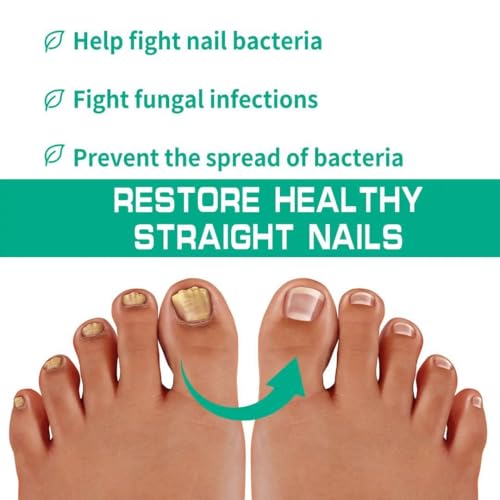 Image of 35ml Natural Nail Surface Repair for Pitted, Cracked, and Brittle Nails | Oil Blend to Heal Damaged Nails Beds, Stimulate Growth, and Enhance Strength