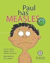 Paul has Measles